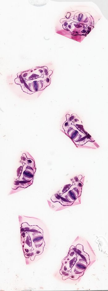 Media type: image; Special Collections 3992   shows specimen_part histological serial section;